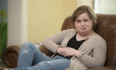 Katie Stubblefield, 21, is the youngest face transplant recipient in the U.S. Prior to her surgery, she received countless hours of therapy from MetroHealth caregivers. Liz Galvin, an occupational therapist, Mandy Simmons, a physical therapist, and Sue Ann Philippbar, a speech pathologist, were greeted with open arms by Katie and her parents,... 